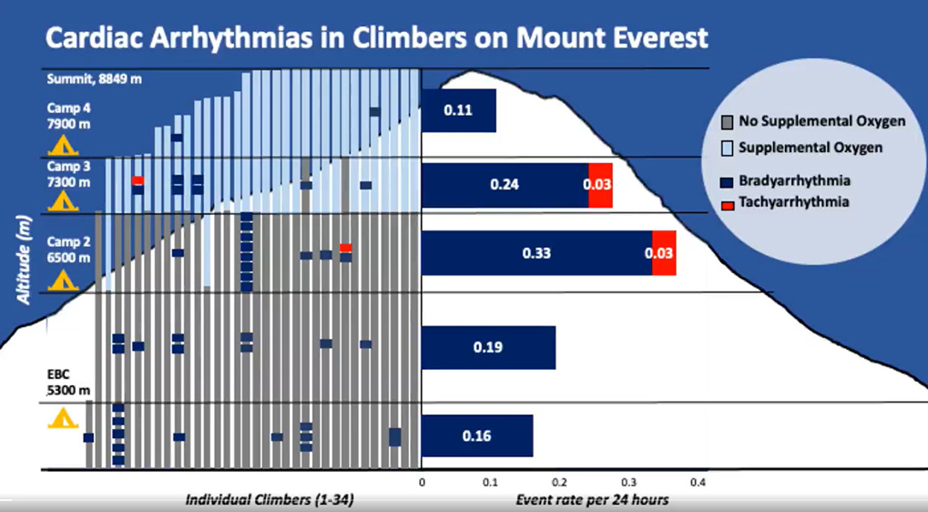 chart showing arrythmias