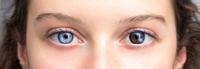 different color eyes
